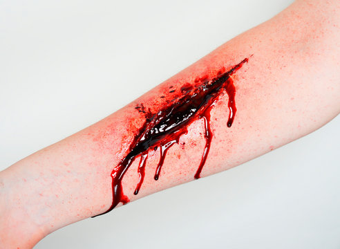 Personal Accident